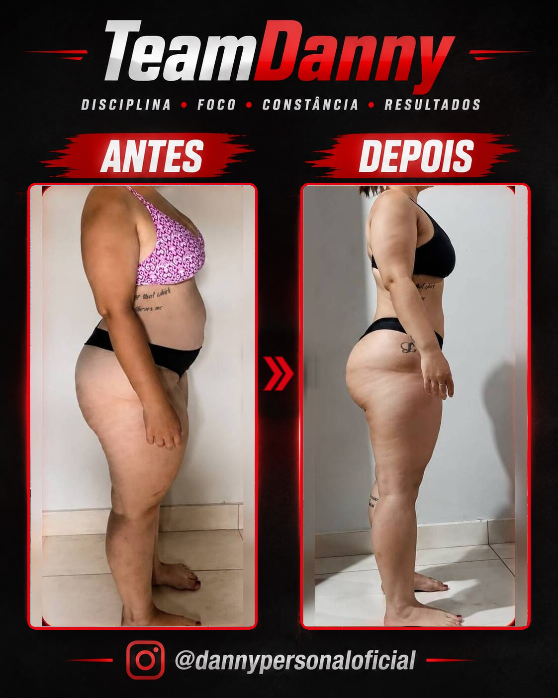 Antes e depois — resultado real TeamDanny 10