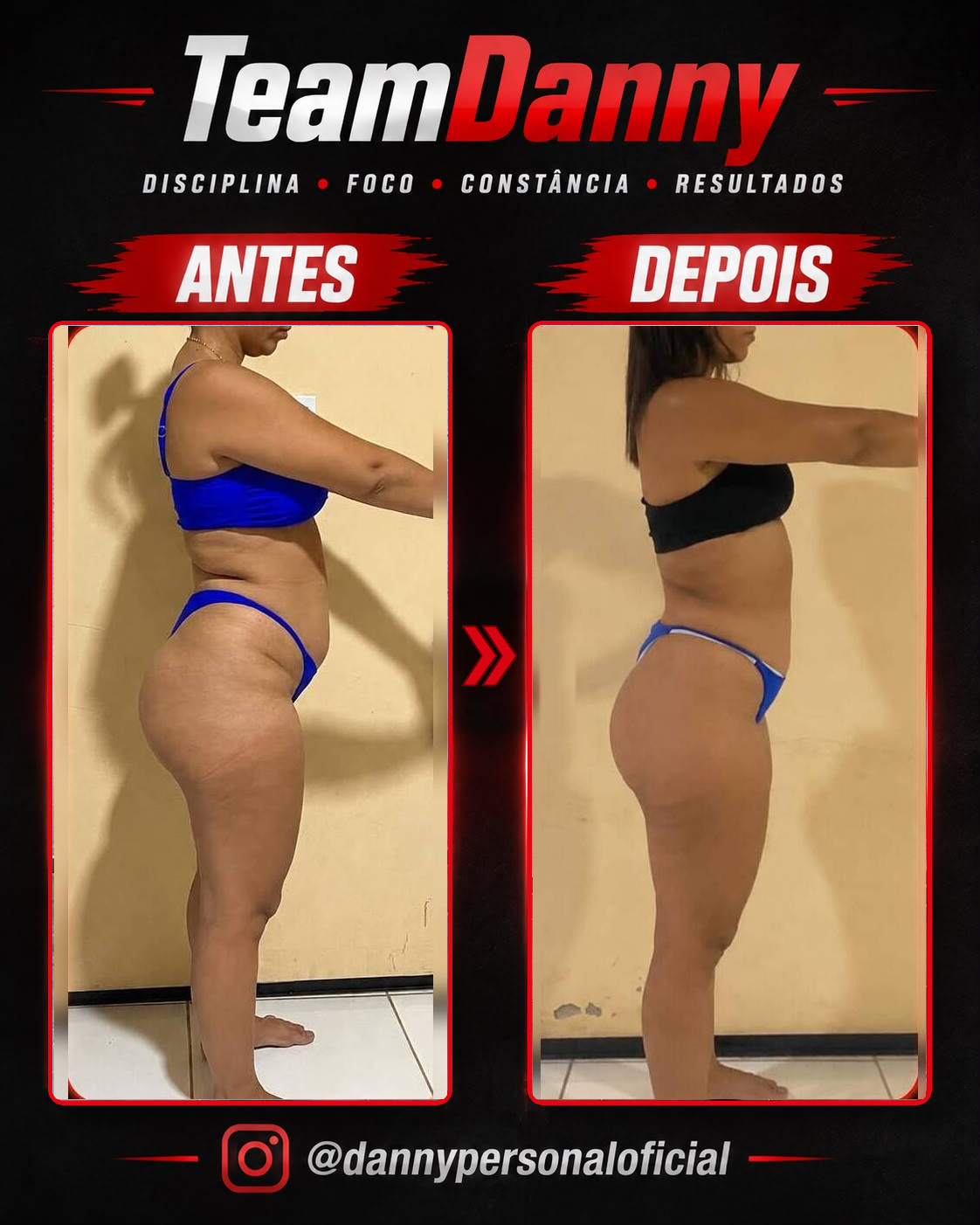 Antes e depois — resultado real TeamDanny 11